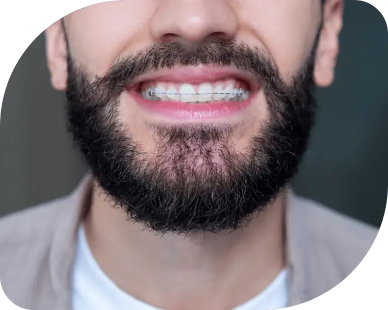 services_kieferorthopädie