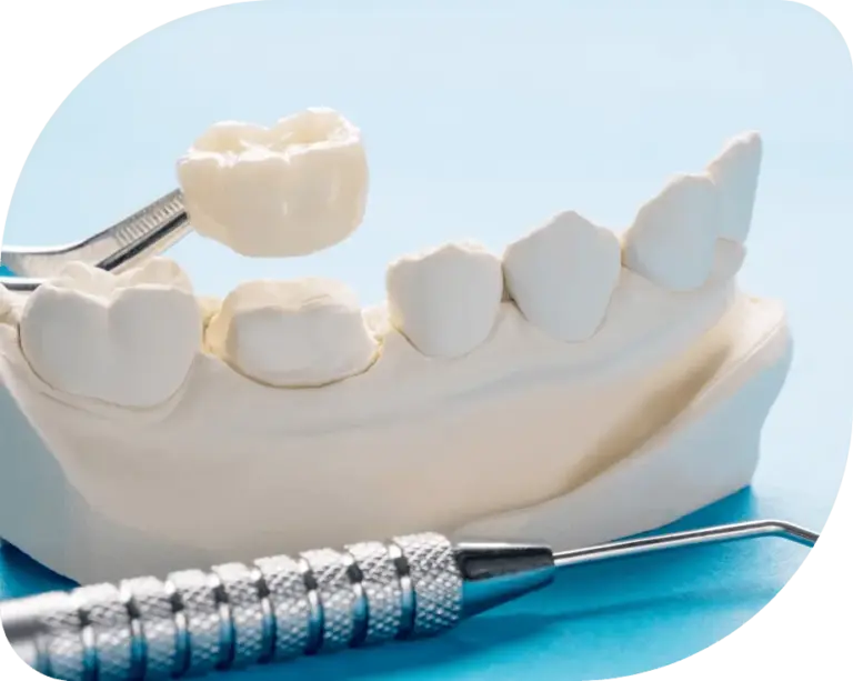 services_prothetische_zahnheikunde